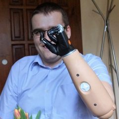 Mirek – dłonie Bebionic, czyli szansa na lepsze życie…